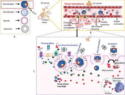 Evaluation of the potential of ultrasound-mediated drug delivery for the treatment of ovarian cancer through preclinical studies